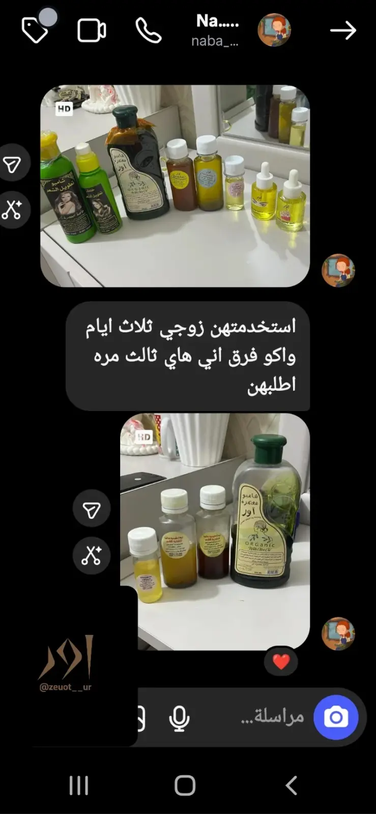 صورة رأي 5