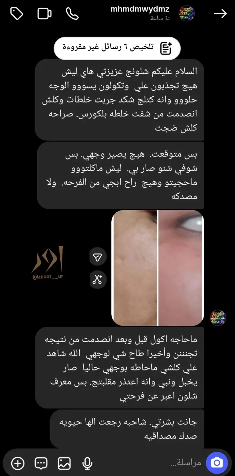 صورة رأي 1