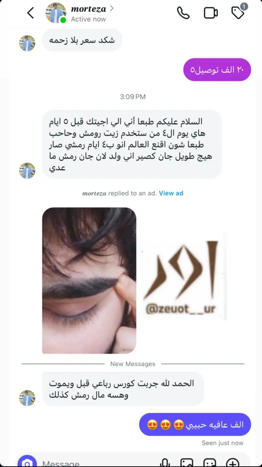 صورة رأي 3